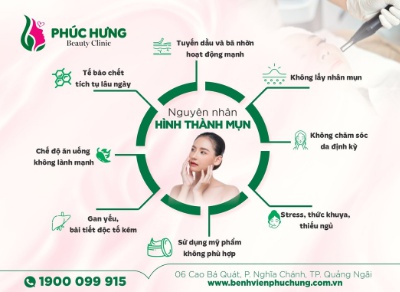 Nguyên nhân hình thành mụn là gì?