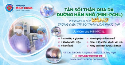 Phẫu thuật tán sỏi thận qua da bằng đường hầm nhỏ: Giải pháp tiên tiến, hiểu quả cho bệnh lý sỏi thận