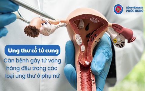 TẦM SOÁT UNG THƯ CỔ TỬ CUNG